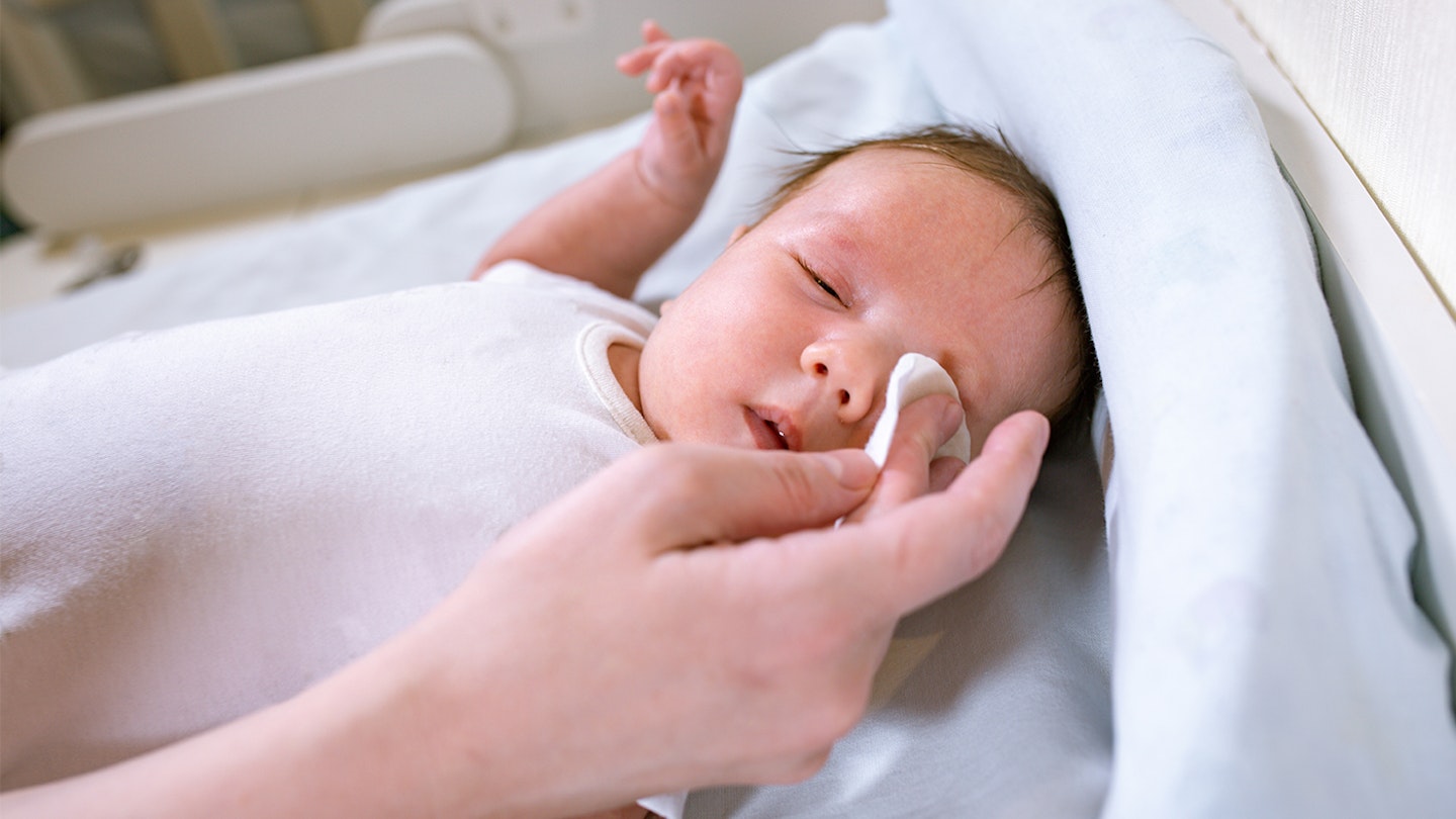 Baby with Conjunctivitis