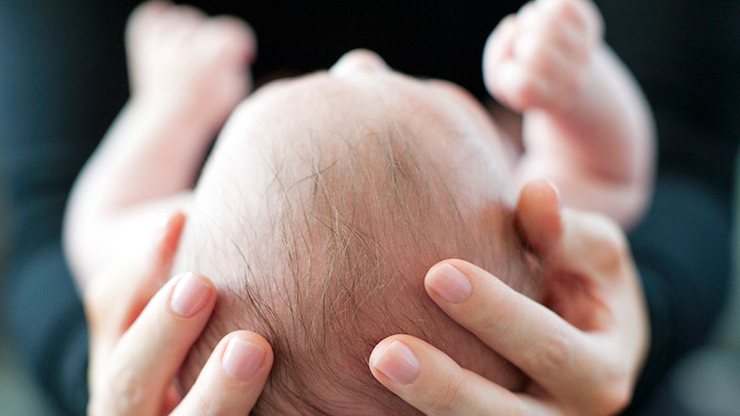 Cradle cap