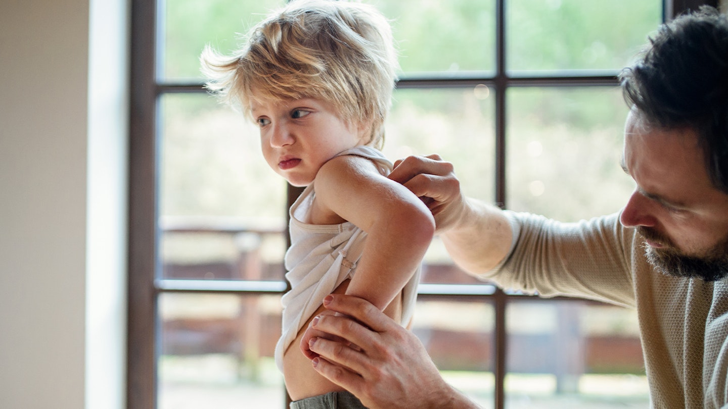 toddler rash